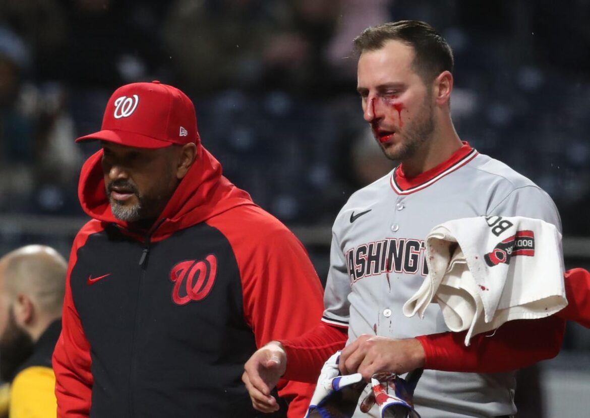 nationals-paul-dejong-leaves-game-after-being-hit-in-the-face-by-a-pitch-from-pirates-mitch-keller-fox-sports.jpg Nationals’ Paul DeJong leaves game after being hit in the face by a pitch from Pirates’ Mitch Keller – FOX Sports